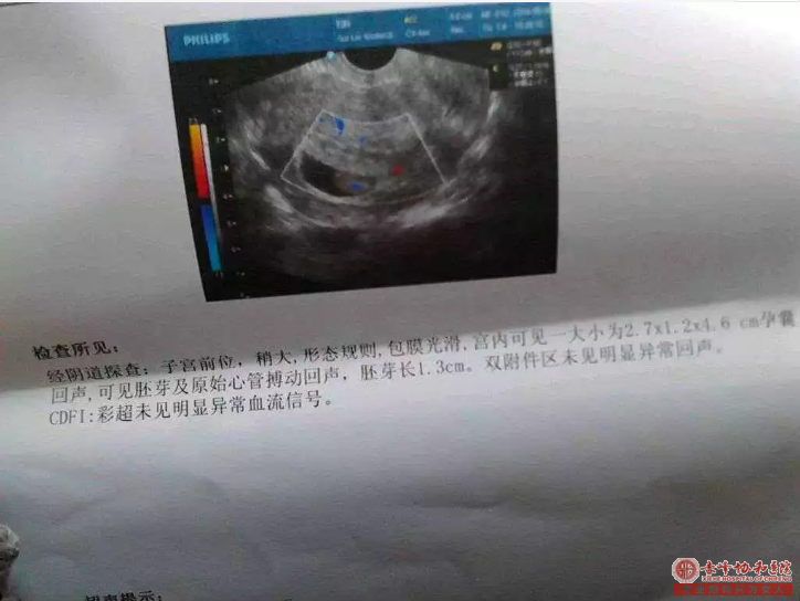 宁德蕉城时代医院早孕检查？验血能验出怀孕吗？